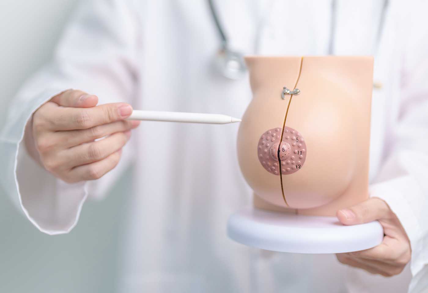 chirurgie mamelon