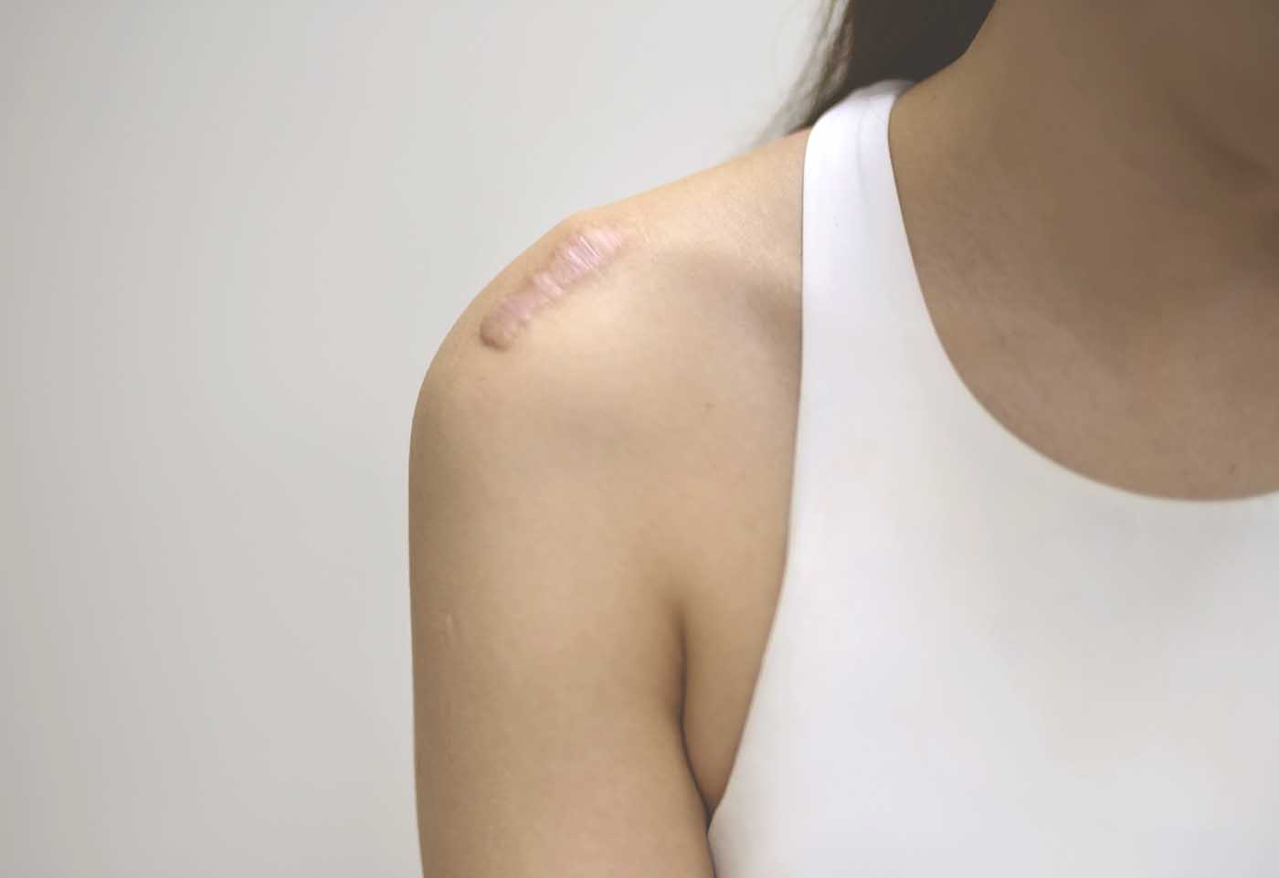 dermatologie montauban